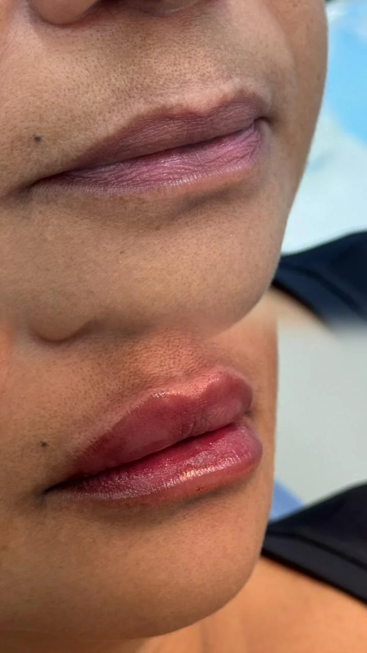 Registro clínico labial comparativo 01