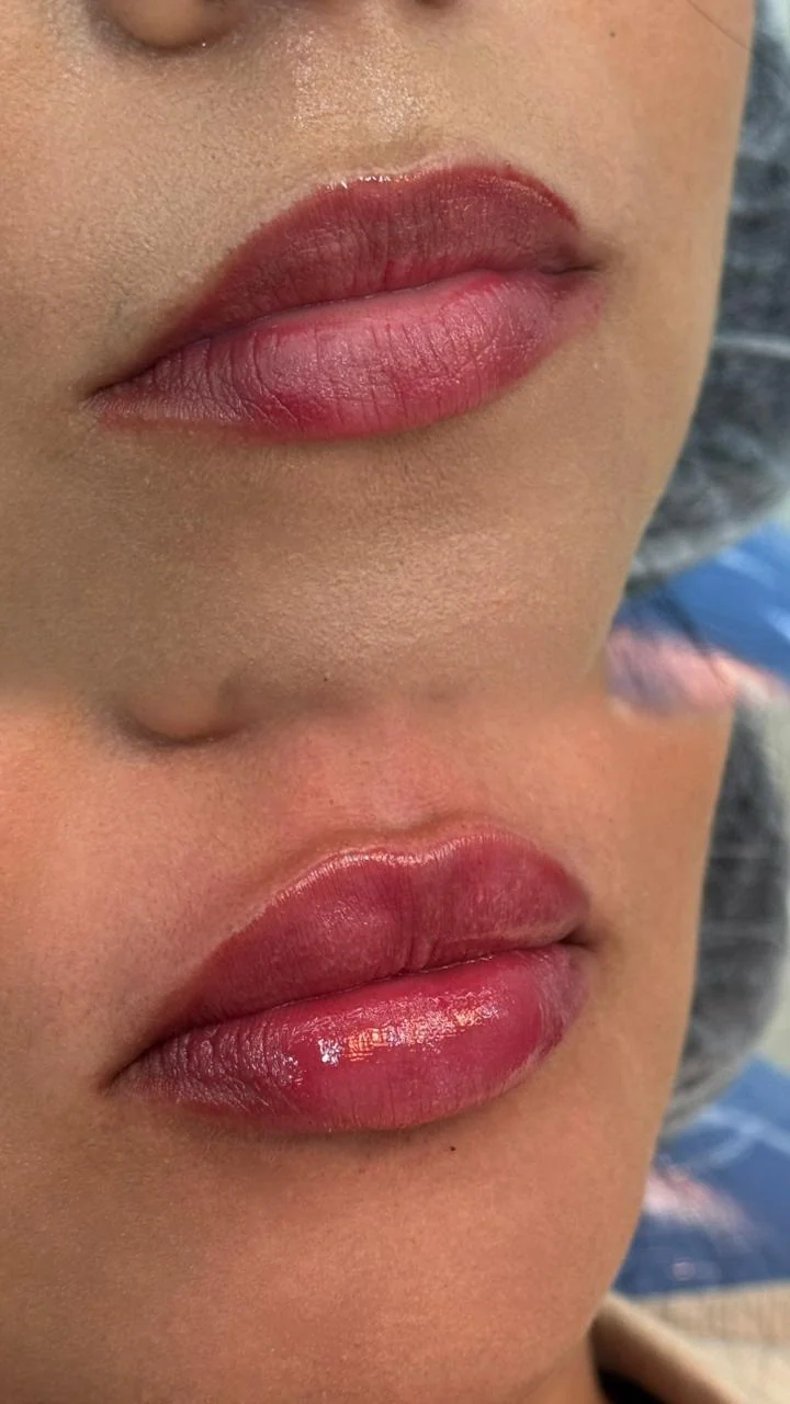 Registro clínico labial comparativo 02