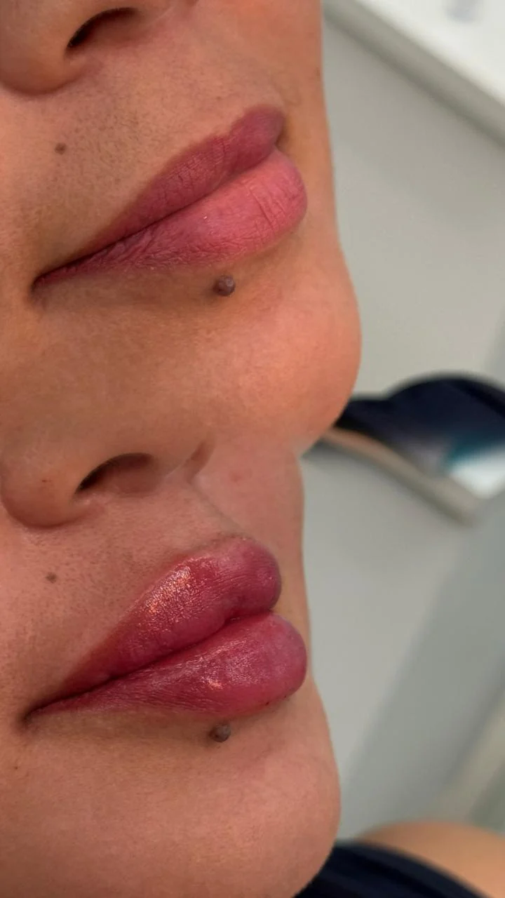 Registro clínico labial comparativo 03